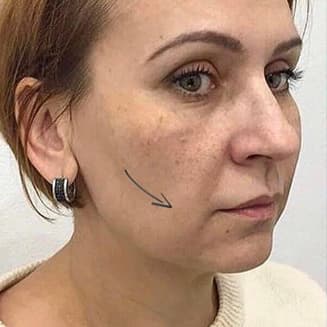 Before example photo